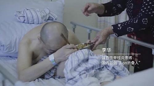 身體被敲斷4次的折疊人出院，打開折疊人生(圖2)