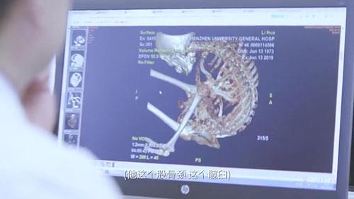 身體被敲斷4次的折疊人出院，打開折疊人生(圖6)